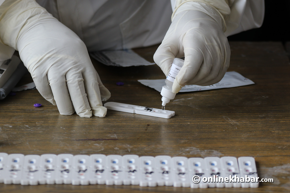 र्‍यापिड टेस्ट रोक्न कांग्रेसको माग