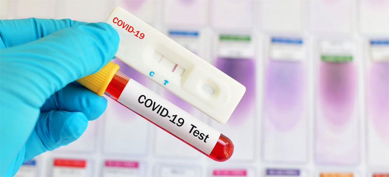 महोत्तरीका एक जनासहित थप दुई जनामा कोरोना संक्रमण, संक्रमितको संख्या २७८ पुग्यो