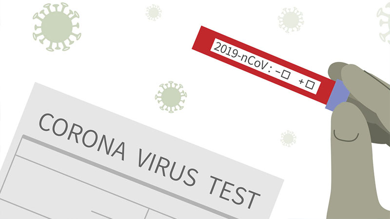 प्रदेश २ कोरोना अपडेटः ९१२ जनाको र्‍यापिड टेस्ट, १४ जना आइसोलेसनमा