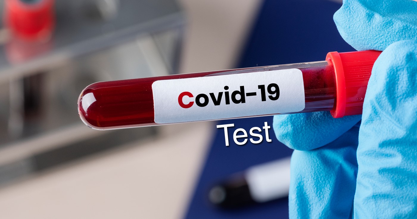 उदयपुरमा थप तीन जनामा कोरोना सङ्क्रमण भेटियो : स्वास्थ्य कार्यालय