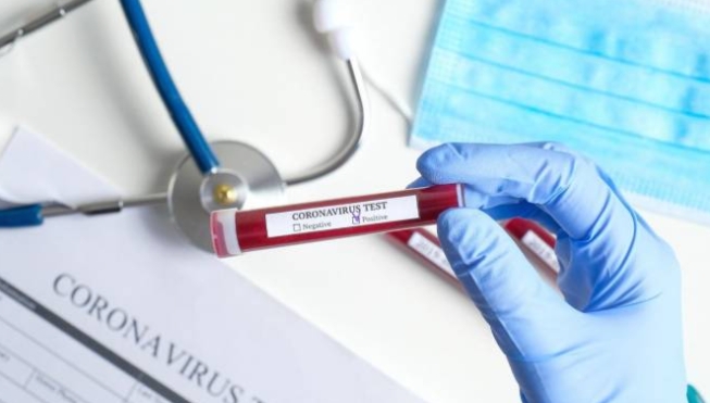 Breaking- आइसोलेशनमा मृत्यु भएका युवकको पिसिआर रिपोर्ट ‘नेगेटिभ’