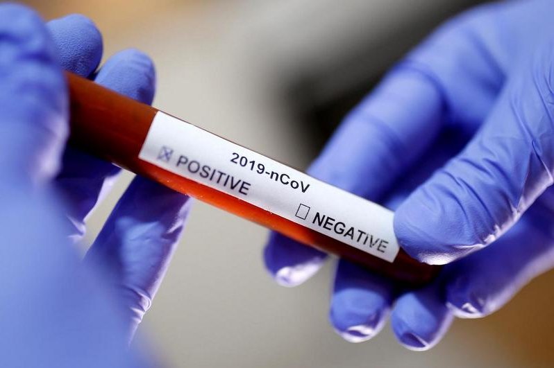 प्रदेश २ मा थप १६ जनामा कोरोना संक्रमणको आशंका