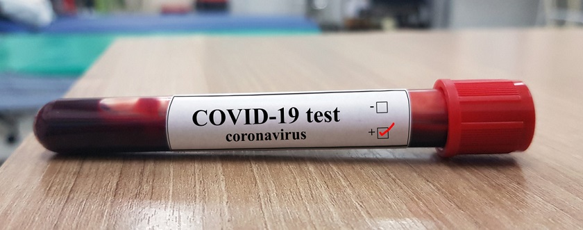 बाँके र रुपन्देहीका सङ्क्रमितको स्वास्थ्य अवस्था सामान्य