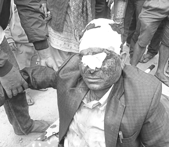 लकडाउनमै कुटिन थाले जनप्रतिनिधि