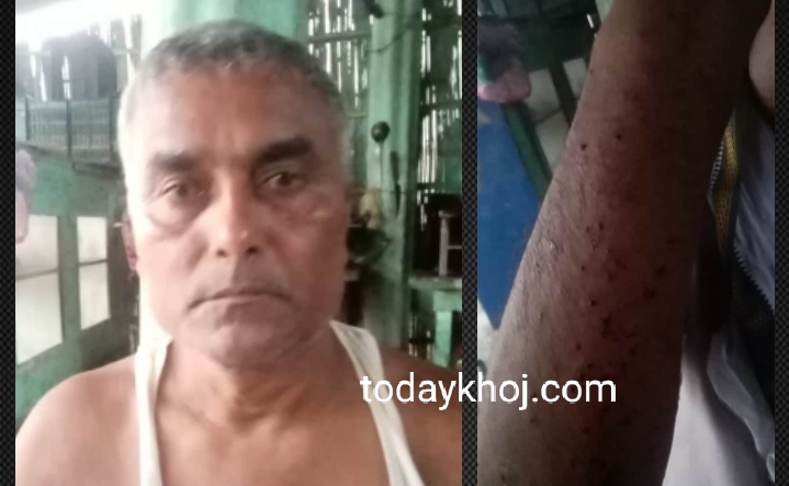 सिरहा : नेकपा नेता सुवरण यादवमाथि आक्रमण गर्नेलाई कारवाही गर्न माग