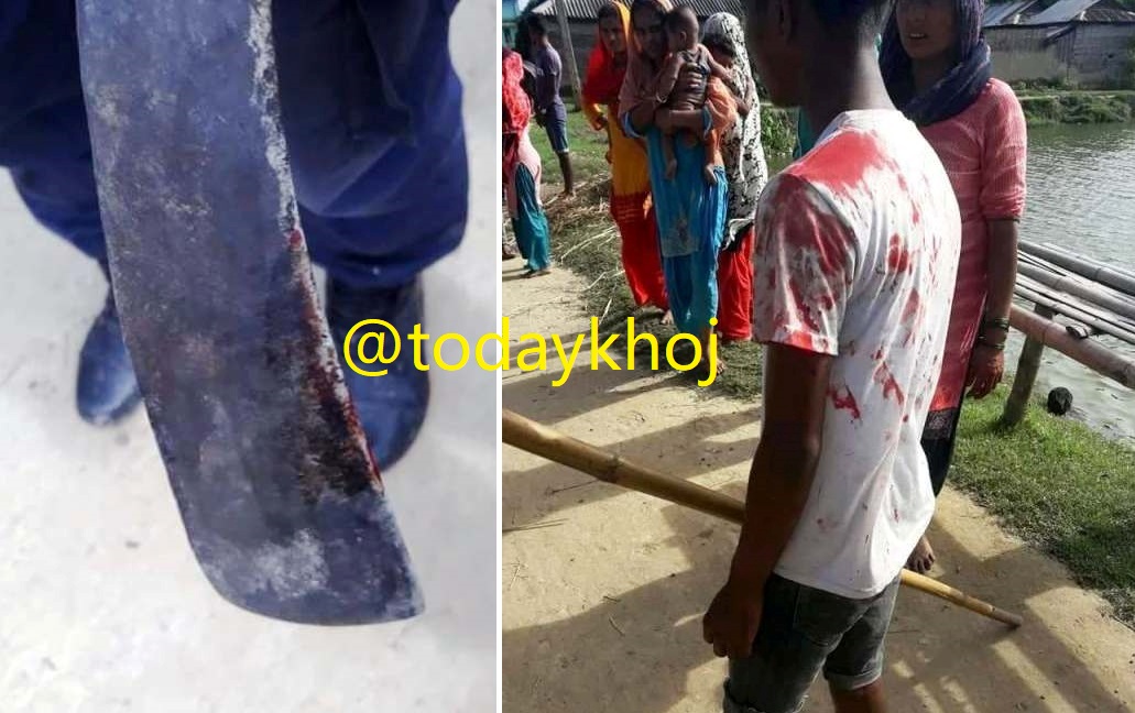 सप्तरी : एमबीबीएसमा अध्ययनरत युवक खानमाथि खुकुरी प्रहार