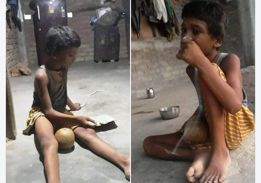 सिरहा : अपाङ्ग छोरालाई छाडेर आमा हिडेपछि….