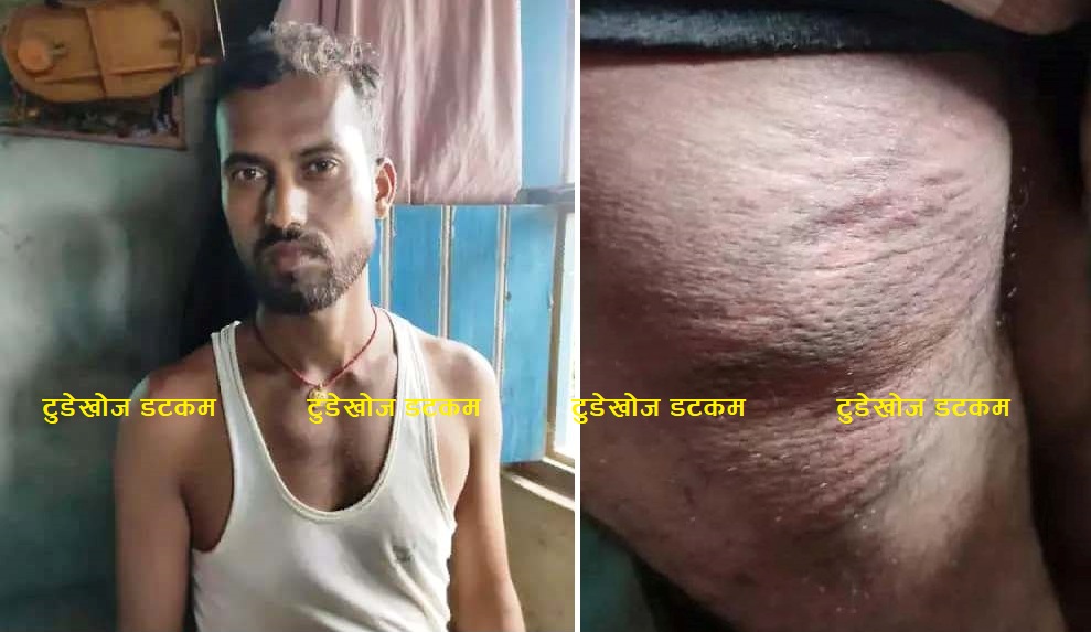 सिमा क्षेत्रमा SSB को ज्यादती, नेपाली नागरिकमाथि निर्घात कुटपिट