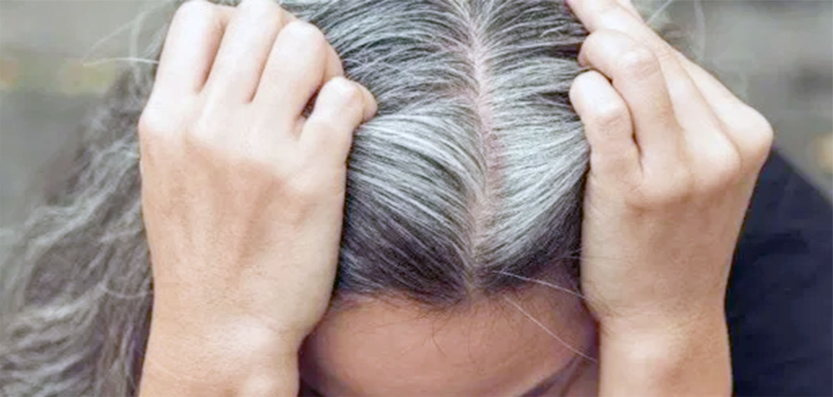 सानै उमेरमा कपाल सेतो हुने समस्याले सतायो ? यसो गर्नुस्