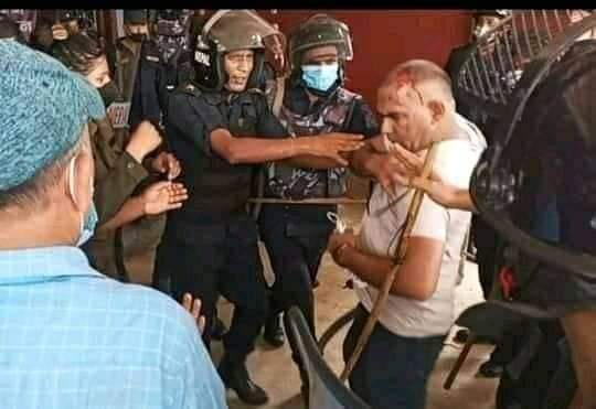 शिक्षक र प्रहरीबीच झडप, १२ जना घाइते