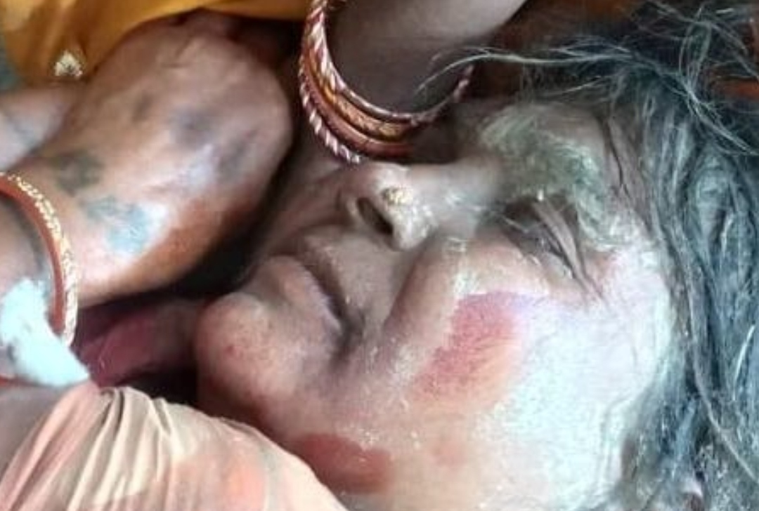 जनकपुर : चाँदीको गहना लुट्न महिलाको ह’त्या गर्ने प्रयास
