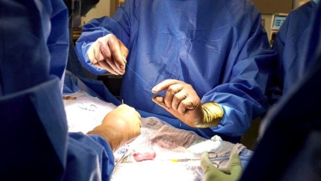 अमेरिकामा एक व्यक्तिमा सुंगुरको मृगौला प्रत्यारोपण गर्न सफल