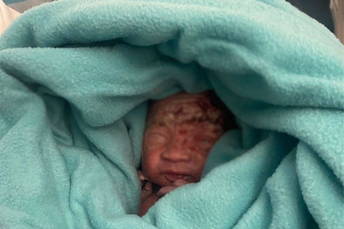 विमानको ट्वाइलेटमा भेटियो भर्खर जन्मेको बच्चा !