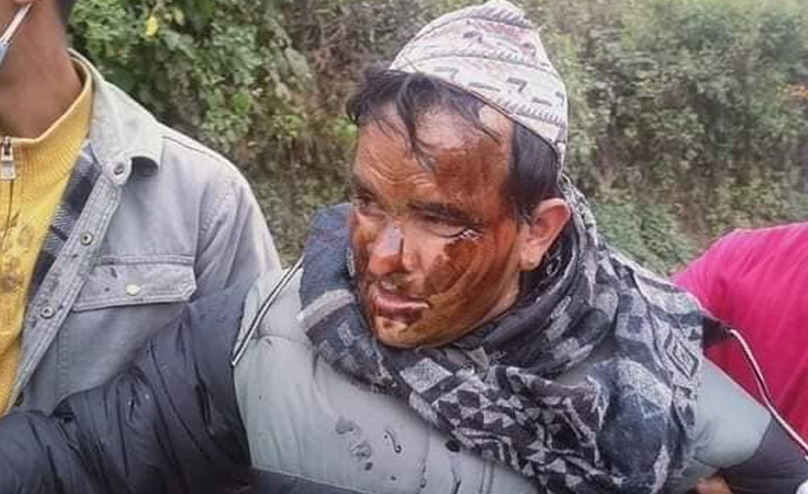 भ्रष्टाचारको आरोपमा वडा अध्यक्ष र सचिवलाई कालोमोसो दलियो