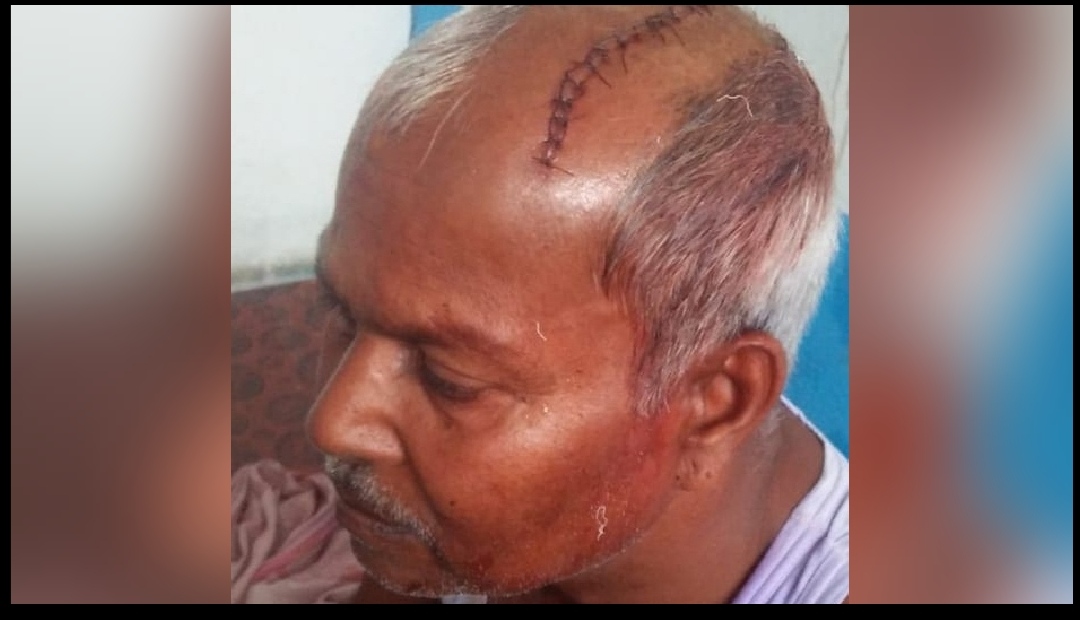 मधेस : बिदा हुन लागेका वडाध्यक्षले कुटे सचिव, टाउकोमा १६ वटा टाँका