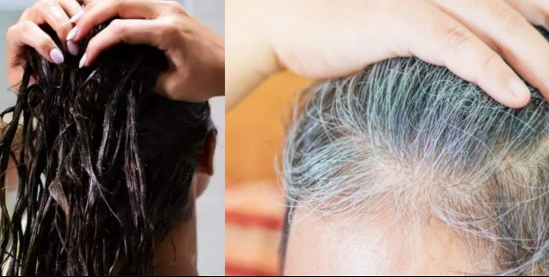 कपाल कहिल्यै फूल्न नदिन र फूलेकोलाई ठिक गर्न गर्नुहोस् यी घरेलु उपाय