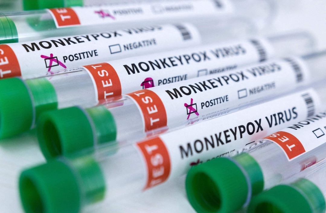 EU signs deal with Bavarian Nordic for supply of 110,000 monkeypox vaccines